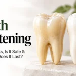 Professional teeth whitening treatment showing a dentist assessing natural tooth shade