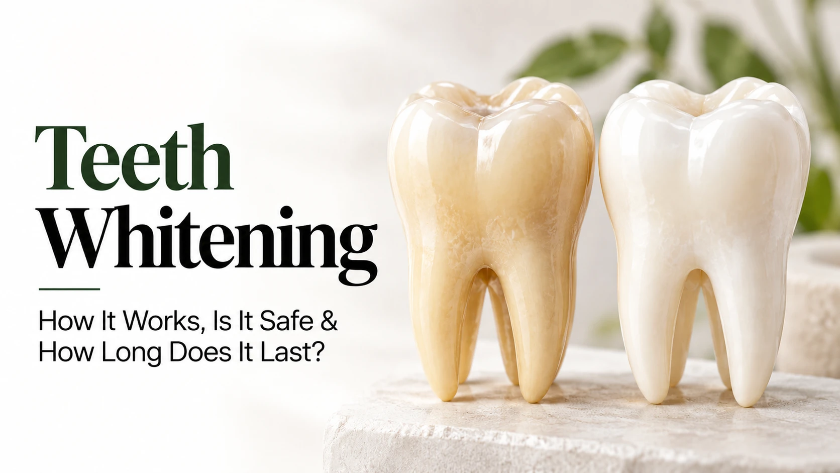 Professional teeth whitening treatment showing a dentist assessing natural tooth shade